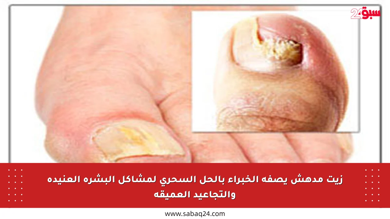 زيت مدهش يصفه الخبراء بالحل السحري لمشاكل البشرة العنيدة والتجاعيد العميقة